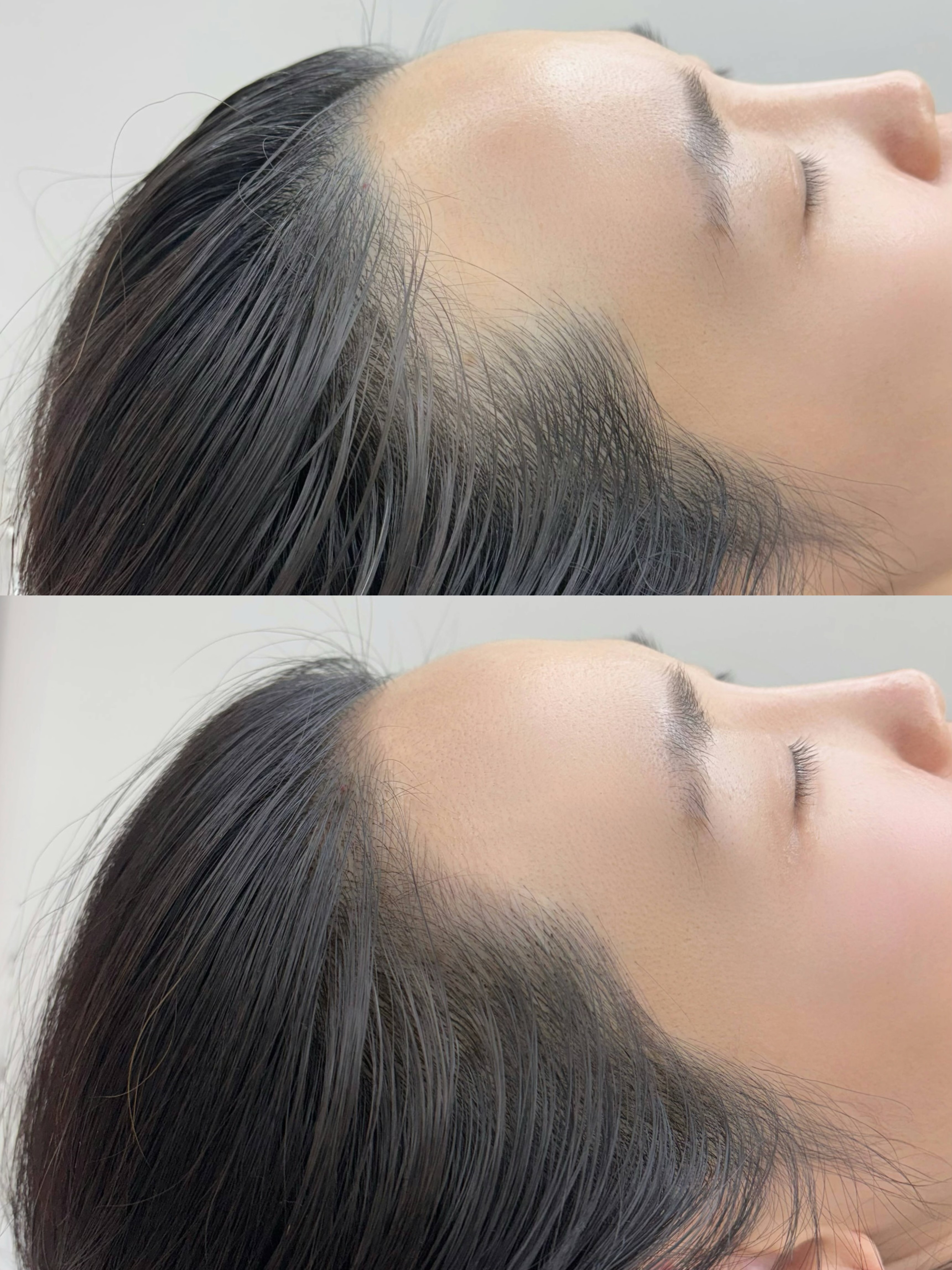 다이아헤어기법